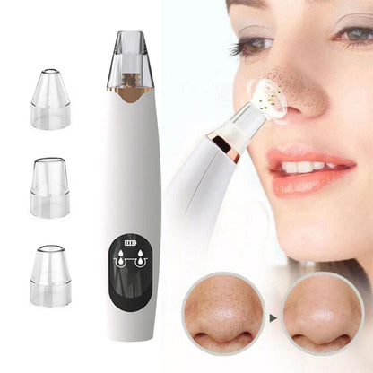 Electric Blackhead Remover Pore Vacuum Sucction machine